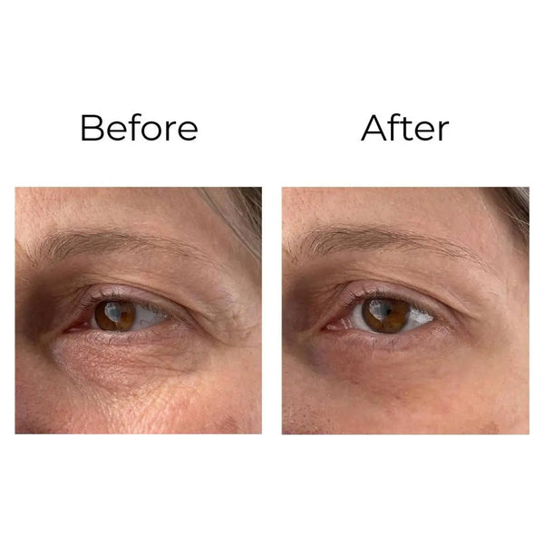 Peptilux Shock Action Augencreme – 20 ml, glättet feine Linien & entspannt die Augenmuskulatur sichtbar
