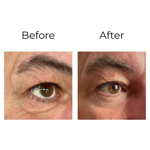 LUX001 Peptilux Augencreme – 20 ml, reduziert Falten & Müdigkeitsanzeichen mit LIPHASYN & Natriumsilikat